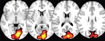 fMRI brain scans.