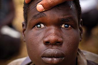 Close up of a blind man, focusing on his eyes.