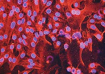Red and purple cell image.